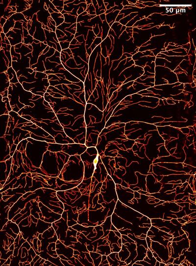 Confocal image of a class IV dendritic arborization neuron at 120 hr